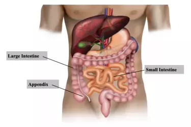 best doctor for appnedix treatment, best hospital for appendix surgery, anand hospital purnia, cost of appendix surgery, Appendectomy Surgery at Anand Hospital, Dr N N Pandit best surgeon in Purnia