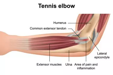 acl pcl injury treatment in purnia