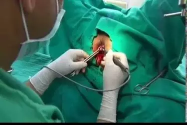 best doctor for piles and fissure treatment in purnia is at Anand Hospital