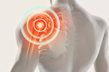 Shoulder pain treatment at anand hospital purnia, Bihar
